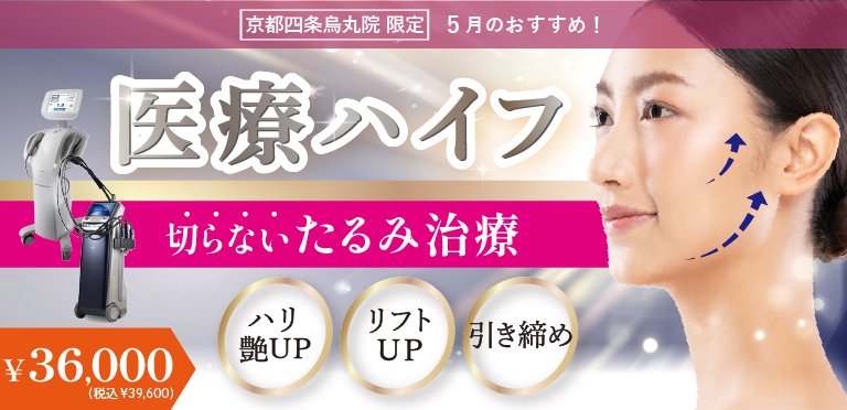 5月のキャンペーンのバナー