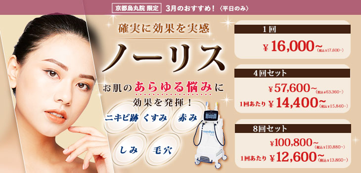 3月のキャンペーンのバナー