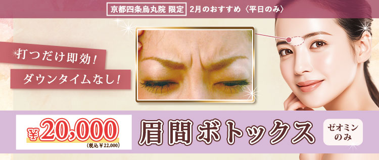 2月のキャンペーンバナー