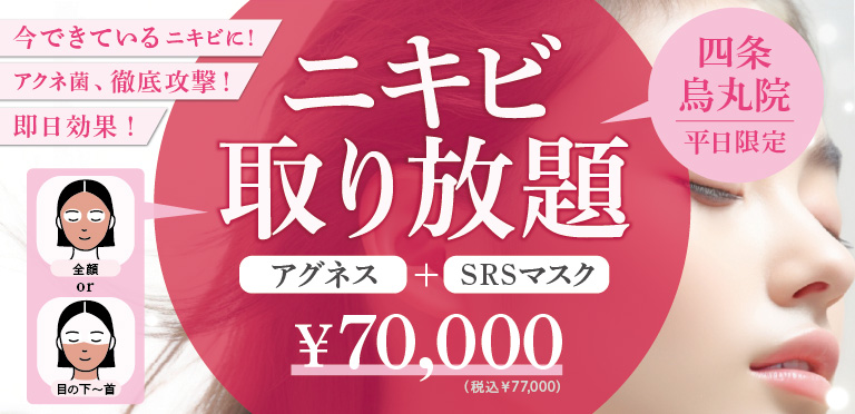 ニキビ取り放題のバナー