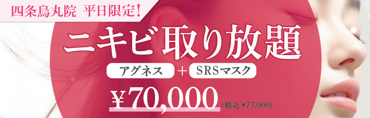 ニキビ取り放題