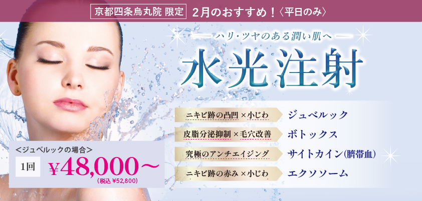 2月のキャンペーンバナー