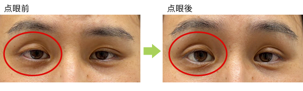 症例写真