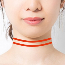両端に針が付いているバイニードル