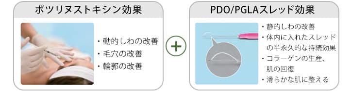 ボツリヌストキシン効果＋PDO/PGLAスレッド効果