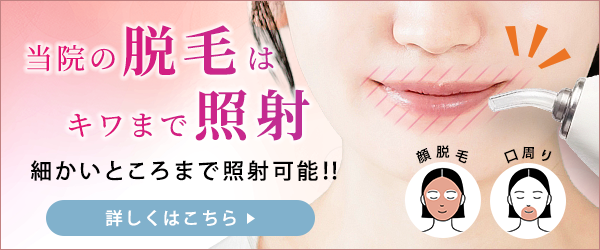 当院の脱毛はキワまで照射のバナー
