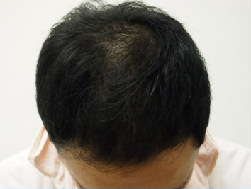 ドクターグロー服用後の写真