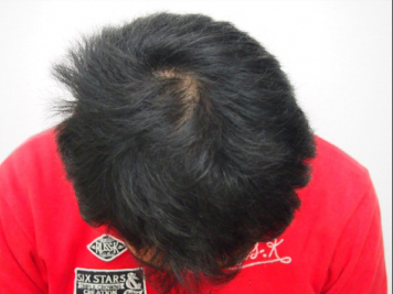 ドクターグロー服用後の写真