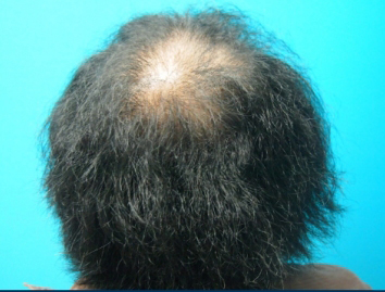 ドクターグロー服用前の写真