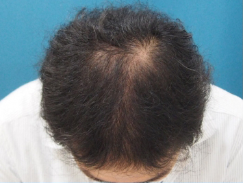 ドクターグロー服用後の写真