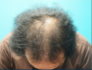 ドクターグロー服用前の写真