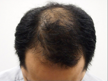 ドクターグロー服用後の写真