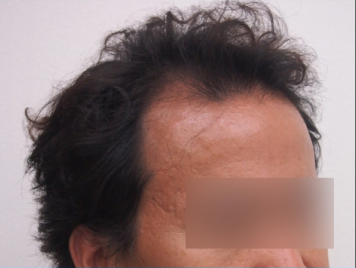 ドクターグロー服用後の写真