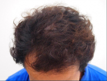 ドクターグロー服用後の写真