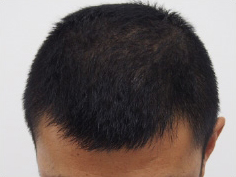 ドクターグロー服用後の写真