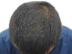 ドクターグロー服用後の写真