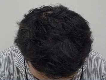 ドクターグロー服用後の写真