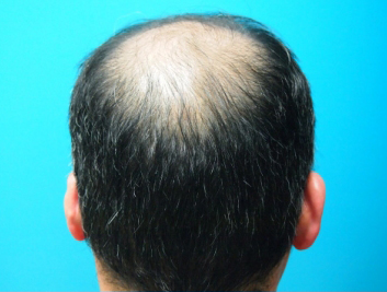 ドグターグロー服用前の写真