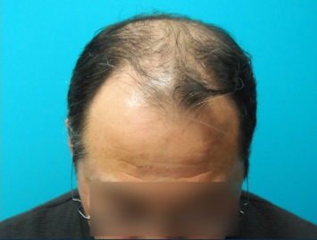 ドグターグロー服用前の写真