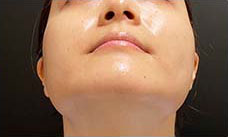 ボックス治療後の写真