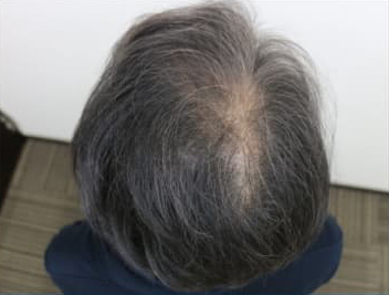 ドグターグロー服用前の写真