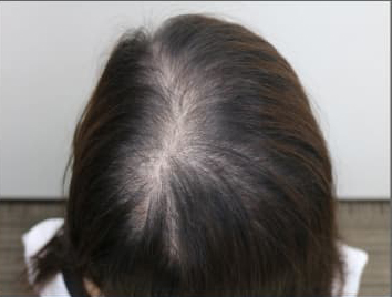 ドグターグロー服用前の写真