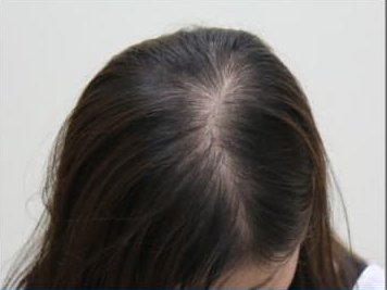 ドグターグロー服用前の写真