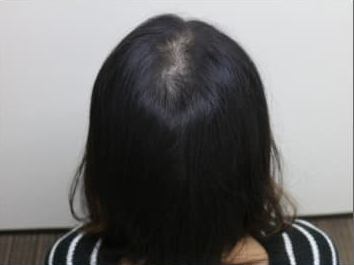 ドクターグロー服用後の写真