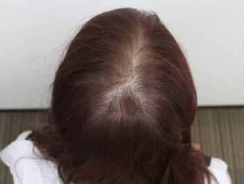 ドグターグロー服用前の写真