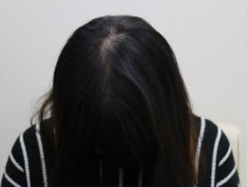 ドクターグロー服用後の写真