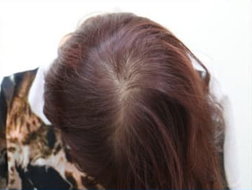 ドグターグロー服用前の写真