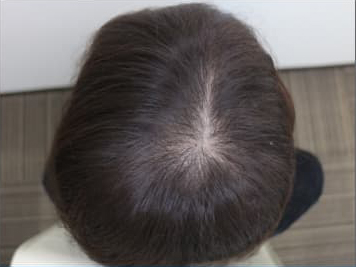 ドクターグロー服用後の写真