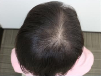 ドグターグロー服用前の写真