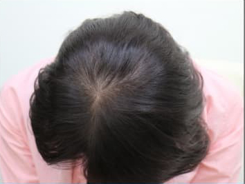 ドグターグロー服用前の写真