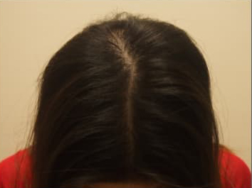 ドクターグロー服用後の写真