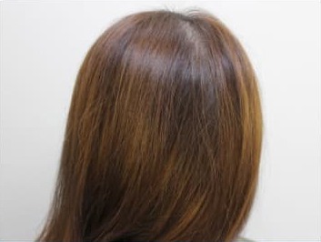 ドクターグロー服用後の写真