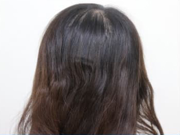 ドグターグロー服用前の写真