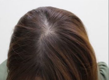 ドクターグロー服用後の写真