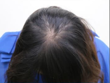 ドグターグロー服用前の写真