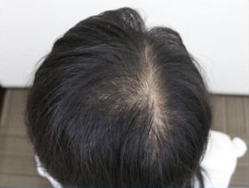 ドグターグロー服用前の写真