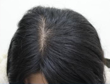 ドクターグロー服用後の写真