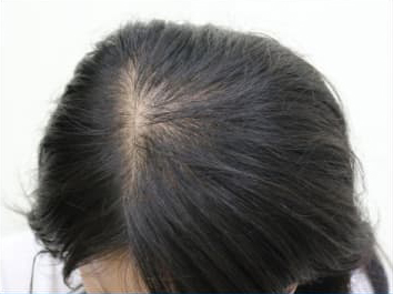 ドグターグロー服用前の写真