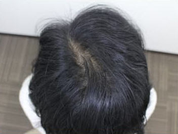 ドクターグロー服用後の写真