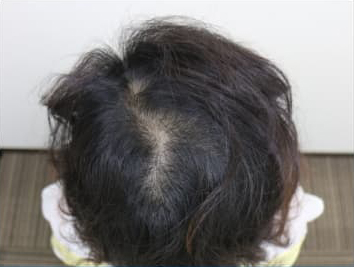 ドグターグロー服用前の写真