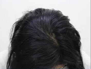 ドクターグロー服用後の写真