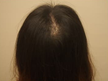 ドクターグロー服用後の写真