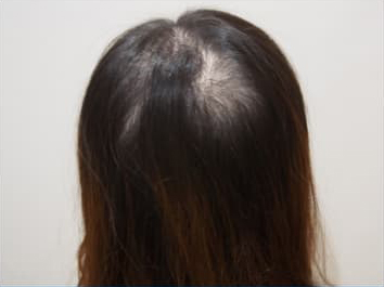 ドグターグロー服用前の写真