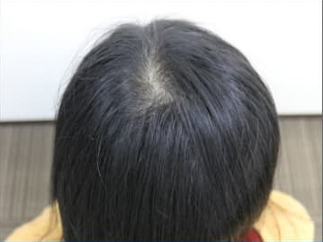 ドクターグロー服用後の写真