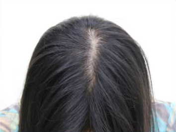 ドグターグロー服用前の写真