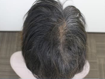 ドクターグロー服用後の写真